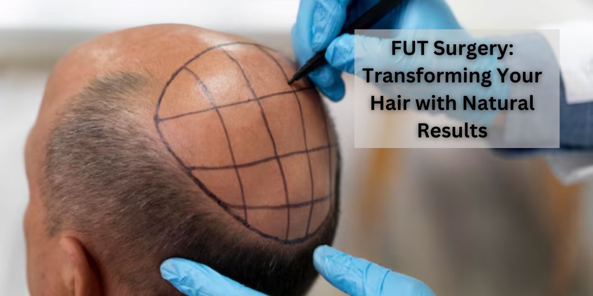 FUT Surgery: Transforming Your Hair with Natural Results