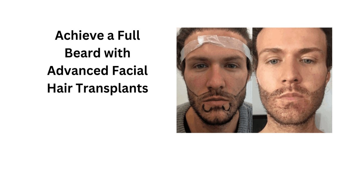 Achieve a Full Beard with Advanced Facial Hair Transplant