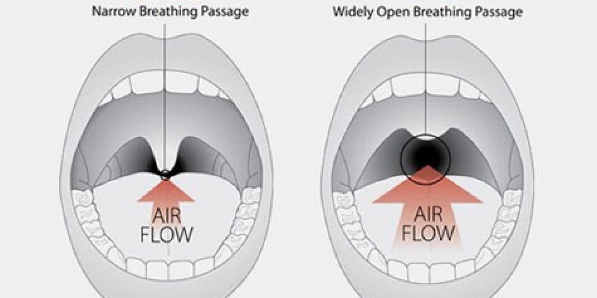 Understanding and Treating Nasal Congestion: Beyond the Common Cold