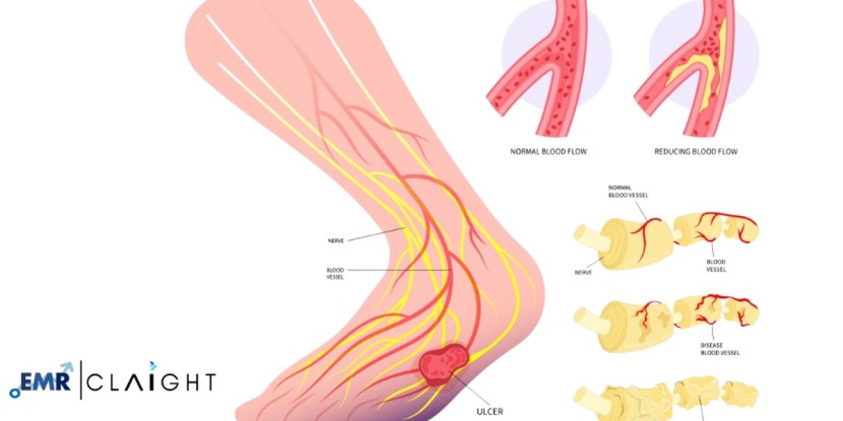 Diabetic Neuropathy Market Outlook: Industry Size, Share & Demand Projections | 2034